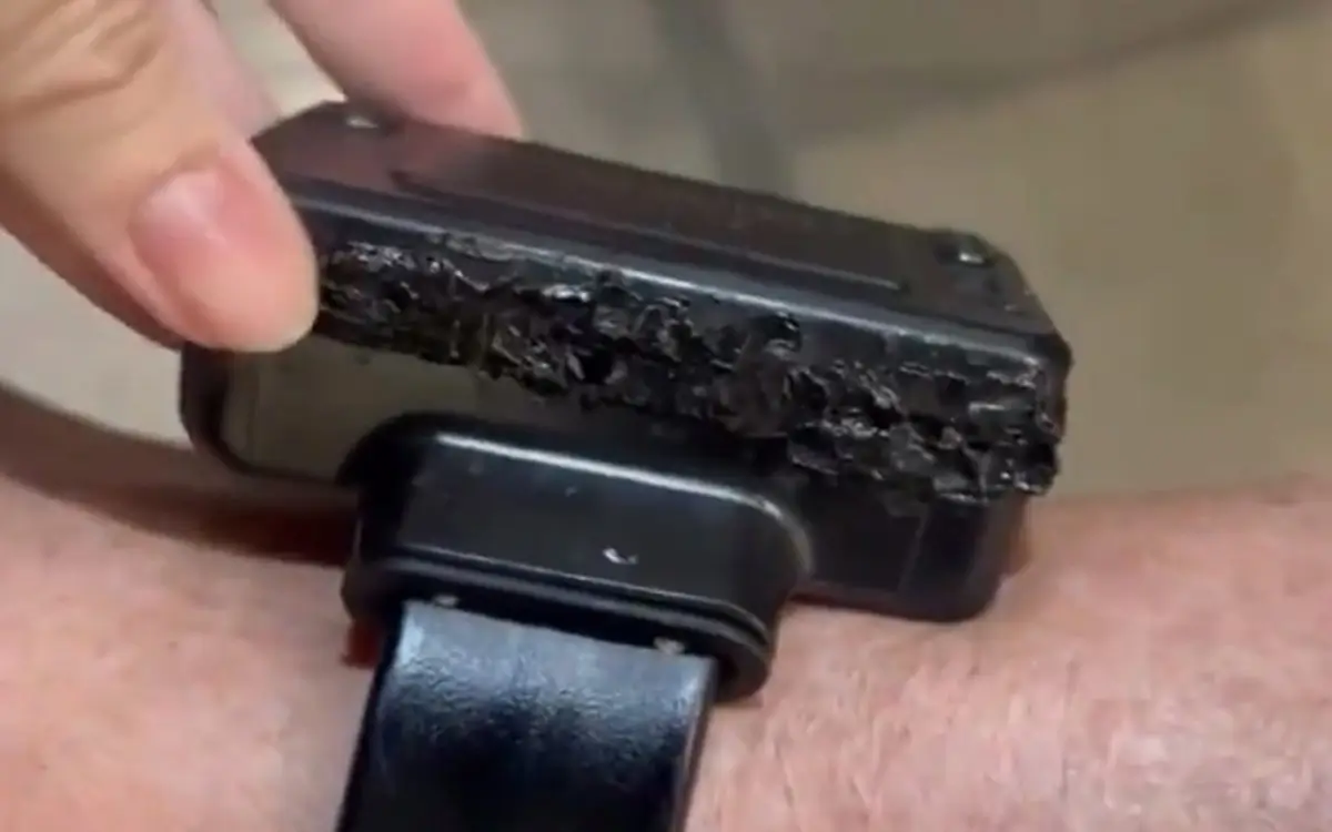 Bolsonaro alega "alucinación" y "paranoia" para justificar su intento de abrir la tobillera