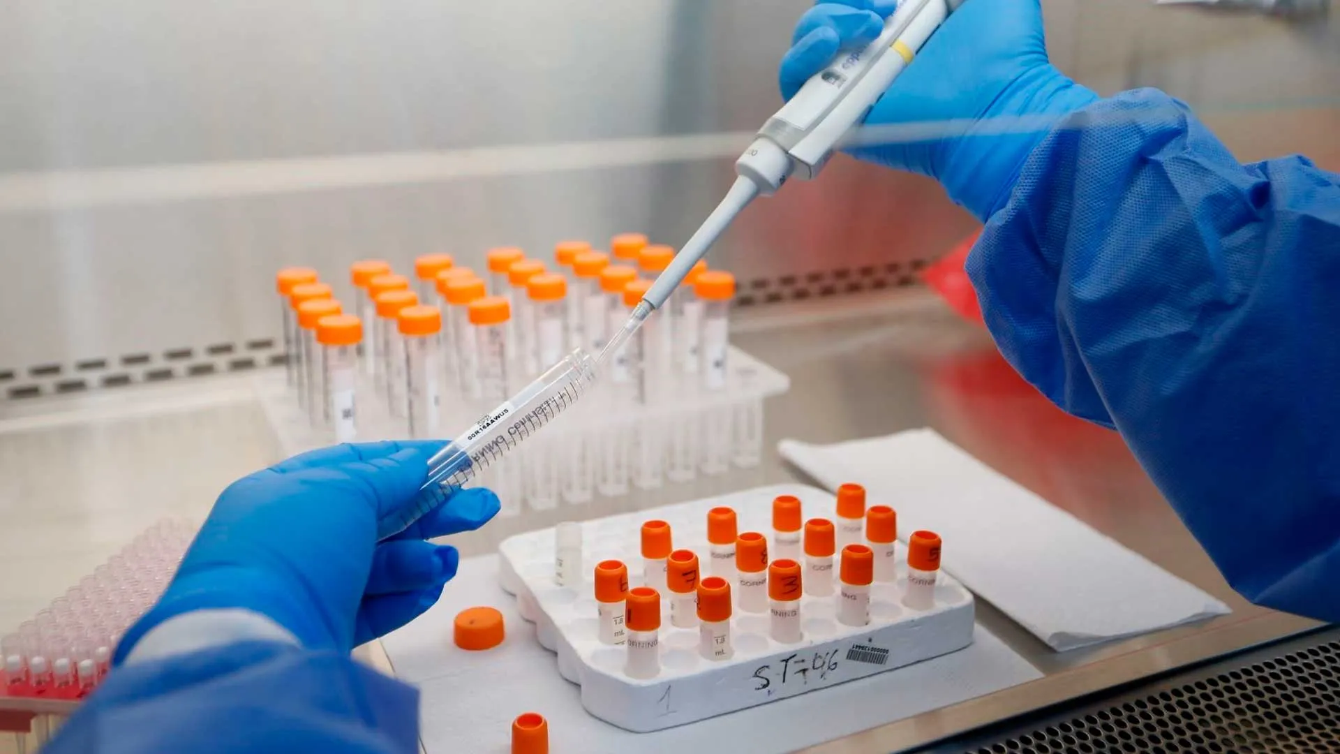 Vacuna contra el coronavirus entra en fase final de ensayo clínico este 27 de julio