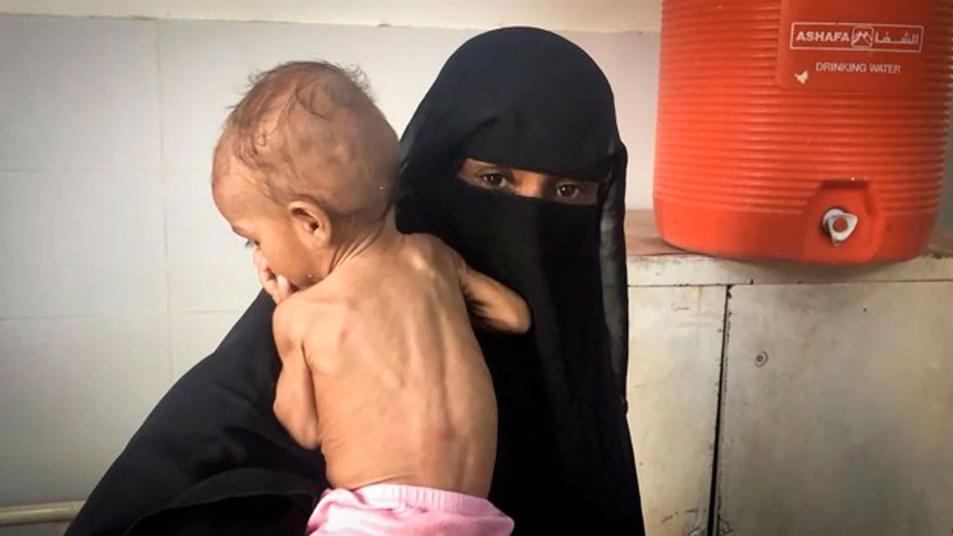 Cada minuto un nino puede morir de hambre en paises en guerra 1