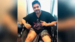 Jerry Rivera mostro la cicatriz de su pierna