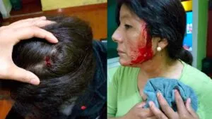 Violenta agresion contra la trabajadora de limpieza Isabel Cortez Me dijeron eso te pasa por estar publicando huevadas